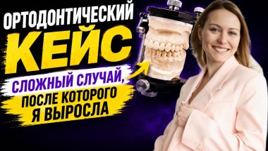 Пациент пришёл из-за одного зуба — а проблема оказалась глубже