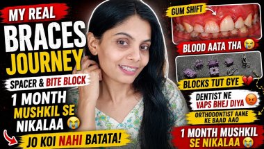 Nobody Told Me Braces Would Be THIS Painful 😭| Spacer & Bite Block Experience #braces #dentist #vlog