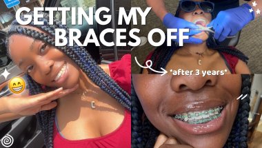 I FINALLY GOT MY BRACES OFF!! *after 3 years*| come with me to get my braces off😱