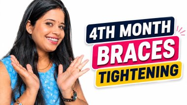 “Braces Adjustment Vlog | Teeth Progress After 4 Months”#smilejourney #teethtransformation