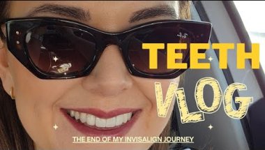 THE END OF MY TEETH JOURNEY! | INVISALIGN | COMPOSITE BONDING 🦷🪥✨️