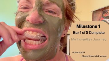 Milestone1_My Personal Invisalign Journey