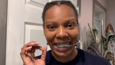 Media 'Braceface Chronicles - May Braces Update' in category 'Headgear'