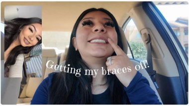 Getting my braces off!