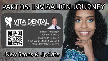PART 35: INVISALIGN UPDATE - NEW SCANS & BREAKDOWN OF MY JOURNEY