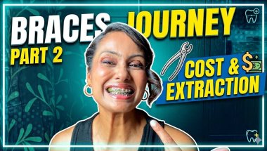 Braces Journey Pt.2 | Total Cost + Tooth Extraction Truth 🦷