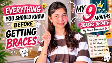 Everything You Should Know Before Getting Braces 🦷 | My 9 Month Braces Update ✨