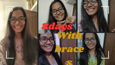 ‼️8days with braces experience ‼️#braces #orthodontics #smile #trending