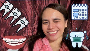 Braces Off After 18 Months… Worth It Ba? 😳