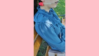 Girl wearing  orthodontic braces and headgear in park PART 2