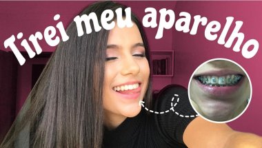 tirando meu aparelho depois de 3 anos