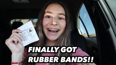 BRACES UPDATE// 6 MONTH PROGRESS (I GOT RUBBER BANDS)