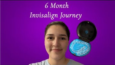 How's it having an invisalign? | 6 month Invisalign journey