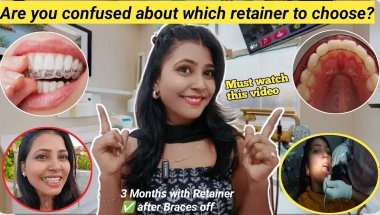 🦷My Braces Journey ll 2 years Braces Experience 😍 / Which Retainer is Right for You? Retainers Time?