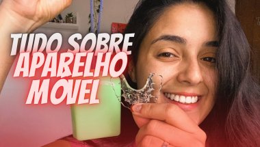 Tudo Sobre Aparelho Móvel - (Vc não consegue falar ? , dói pra colocar ?)