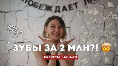 Как я решилась на БРЕКЕТЫ | начало пути, страхи, цены