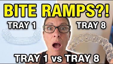 Bite Ramps?! Nobody Warned Me About This / Invisalign Tray 8 of 41