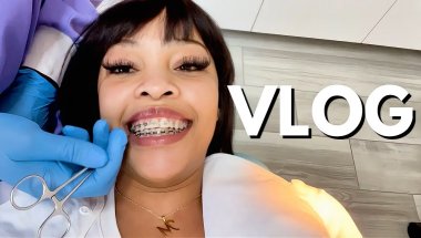 My Braces Are Finally Coming Off! 😭✨ | The Truth About Having Braces