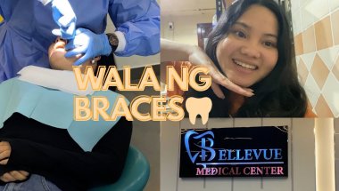 PINATANGGAL KO NA BRACES KO || ANG MAHAL😩 || Ell Parami Vlog || Ell Parami in UAE 🇦🇪
