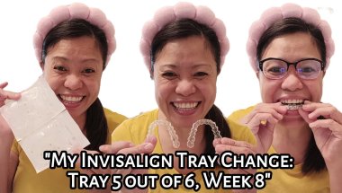 My Invisalign Tray Change: Tray 5 out of 6 | Week 8 | Experience | Tagalog