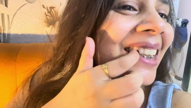 My braces update #vlog #viral #youtube #trending