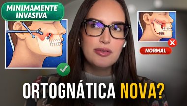 Cirurgia Ortognática Minimamente Invasiva