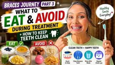 Braces Journey Part 3: Foods I Can & Can’t Eat (+ Cleaning Routine)