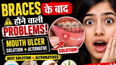 Braces ke bad hone wali problems// my braces journey// #trending #minivlog #vlog #yt