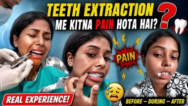 😭 Teeth Extraction Pain Vlog | Dentist Appointment Day 🦷 | Kitna Pain Hua?#TeethExtraction#vlog