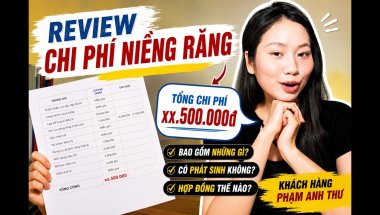 Review Chi Phí Niềng Răng: Mình Đã  Phải Trả Bao Nhiêu Tiền?