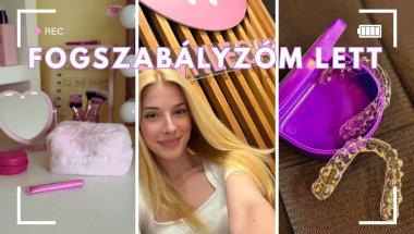 FOGSZABÁLYZÓS LETTEM | storytime,vlog 🦷👩🏼‍⚕️