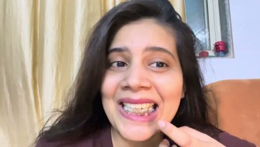 Braces lga kr travel kr sakte hai#dentist #viral #youtube #trending #teeth #youtube h