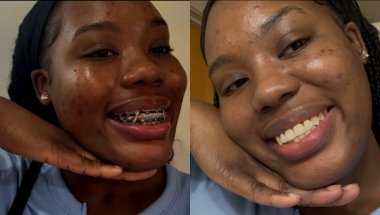 A few days in my life || Got my braces off || LifewithKelly876