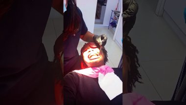 Removing my Braces after 3 years🫩