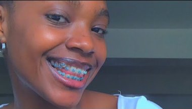 EP 1:WHAT NOBODY TELLS YOU ABOUT BRACES.The Truth about getting braces 10K views . 24 hours ago.