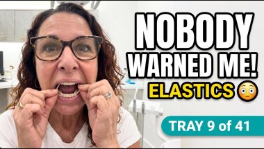 Finally got elastics! Tray 9 of 41 Halo update = ELASTICS